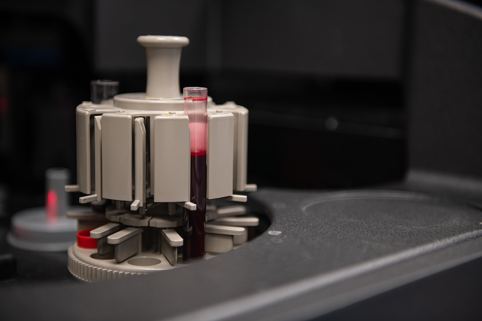 Automated analyser in a clinical laboratory